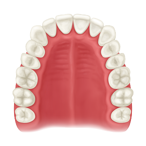 Ridge Augmentation Maintenance