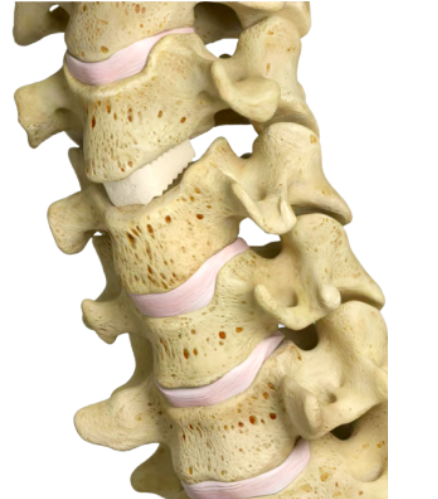 Spine