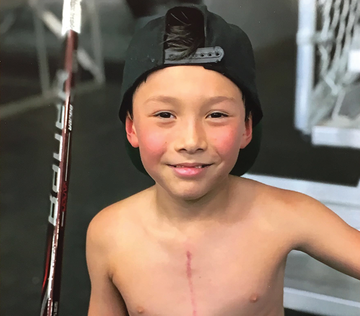 Anderson, heart valve recipient