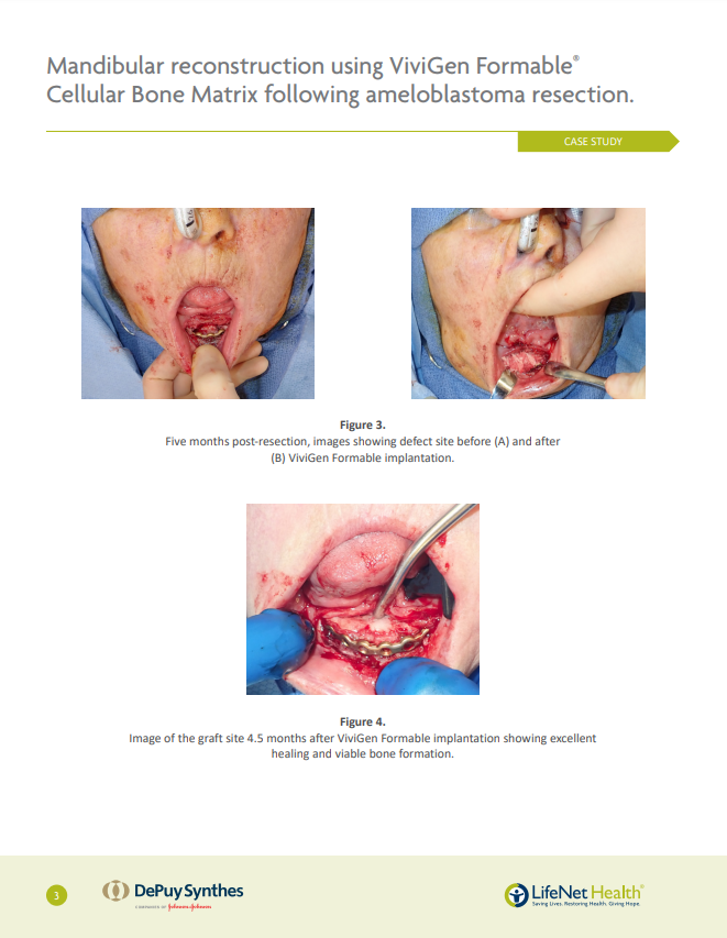 Image of Case Study