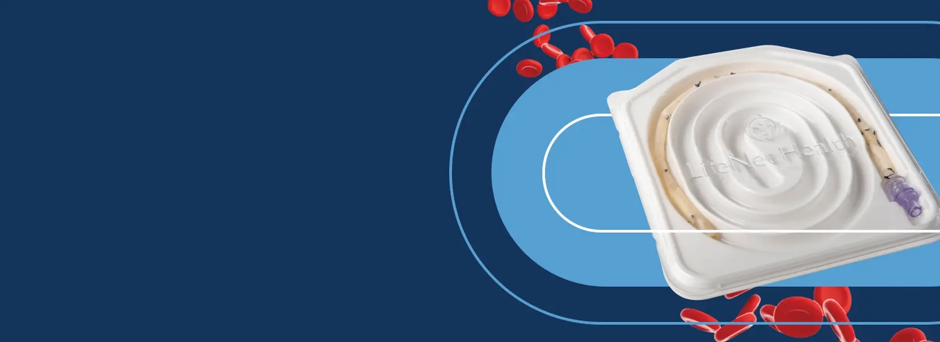 Nexeon® Advanced Vascular Allograft