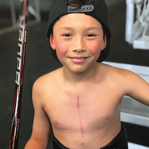 A boy who received a lifesaving tissue implant